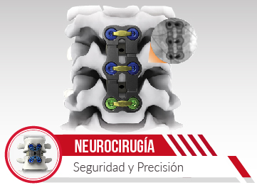 Neurocirugia